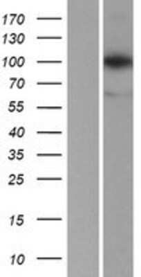 Western Blot: LONP1 Overexpression Lysate [NBP2-07825]