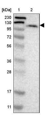 Western Blot: LONP2 Antibody [NBP1-81294]