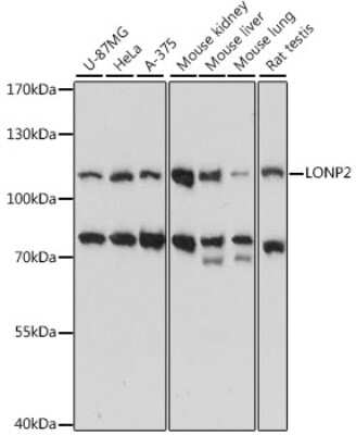 Western Blot: LONP2 AntibodyAzide and BSA Free [NBP3-04648]