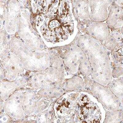 Immunohistochemistry-Paraffin: LONRF1 Antibody [NBP1-83578]