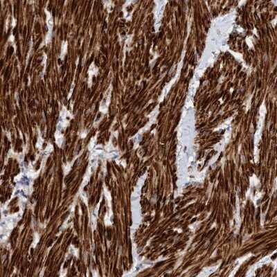 Immunohistochemistry-Paraffin: LONRF1 Antibody [NBP1-83579]