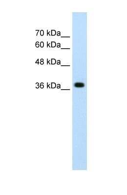 Western Blot: LONRF1 Antibody [NBP1-55072]