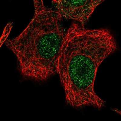 Immunocytochemistry/ Immunofluorescence: LONRF2 Antibody [NBP2-56830]