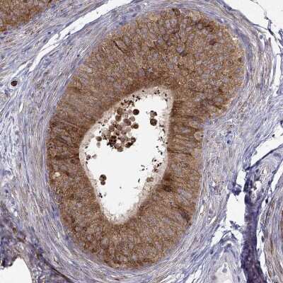 Immunohistochemistry-Paraffin: LONRF2 Antibody [NBP2-56830]