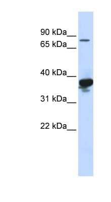 Western Blot: LONRF2 Antibody [NBP1-59292]