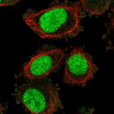 Immunocytochemistry/ Immunofluorescence: LONRF3 Antibody [NBP2-47391]