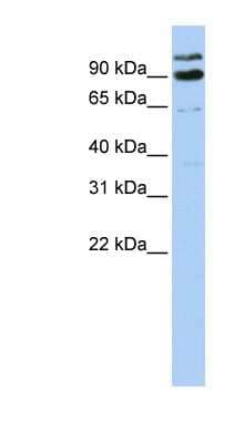 Western Blot: LONRF3 Antibody [NBP1-54834]