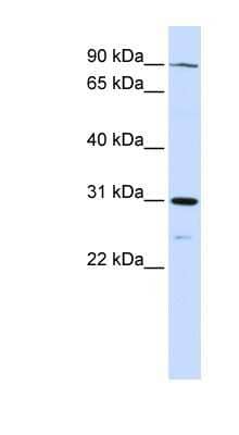 Western Blot: LONRF3 Antibody [NBP1-55065]