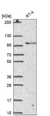 Western Blot: LONRF3 Antibody [NBP2-68769]