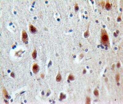 Immunohistochemistry-Paraffin: LOX-1/OLR1 Antibody [NBP2-27298]