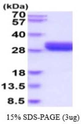 SDS-PAGE: Recombinant Human LOX-1/OLR1 His Protein [NBP2-53074]