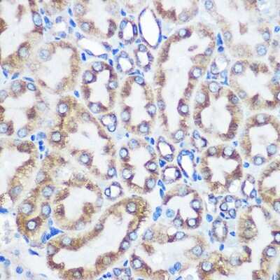Immunohistochemistry-Paraffin: LOX Antibody (9K10Z3) [NBP3-15396]
