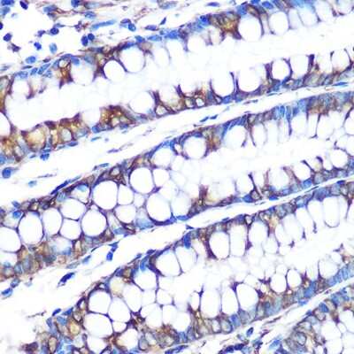 Immunohistochemistry-Paraffin: LOX Antibody (9K10Z3) [NBP3-15396]