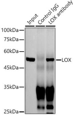 Immunoprecipitation: LOX Antibody (9K10Z3) [NBP3-15396]