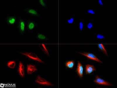 Immunocytochemistry/ Immunofluorescence: LOX Antibody [NB100-2527]