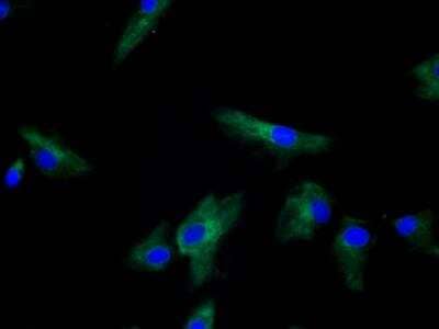Immunocytochemistry/ Immunofluorescence: LOX Antibody [NB100-2527]