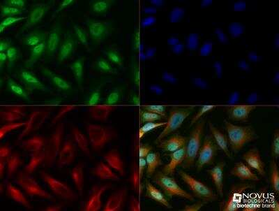 Immunocytochemistry/ Immunofluorescence: LOX Antibody - BSA Free [NB100-2530]