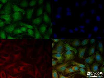 Immunocytochemistry/ Immunofluorescence: LOX Antibody [NBP2-24877]