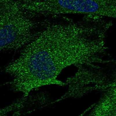 Immunocytochemistry/ Immunofluorescence: LOX Antibody [NBP2-55446]