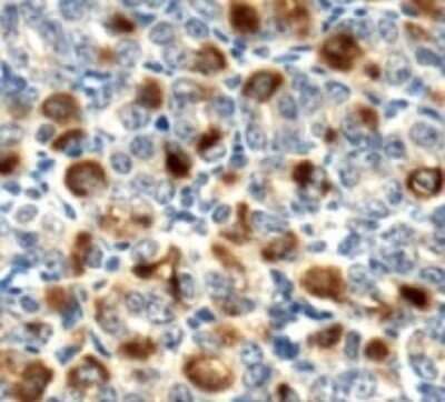 Immunohistochemistry: LOX Antibody [NB100-2527]