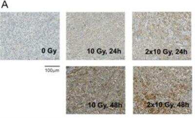 Immunohistochemistry: LOX Antibody [NB100-2527]