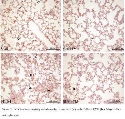 Immunohistochemistry-Paraffin: LOX Antibody [NB100-2527]