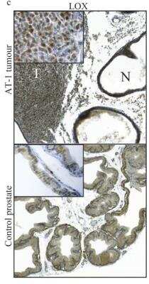 Immunohistochemistry-Paraffin: LOX Antibody [NB100-2527]