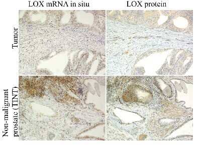 Immunohistochemistry-Paraffin: LOX Antibody - BSA Free [NB100-2530]