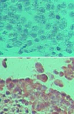 Immunohistochemistry-Paraffin: LOX Antibody [NBP2-24877]