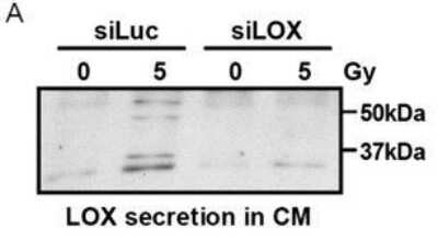 Knockdown Validated: LOX Antibody [NB100-2527]