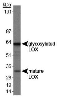 Western Blot: LOX Antibody [NB100-2527]