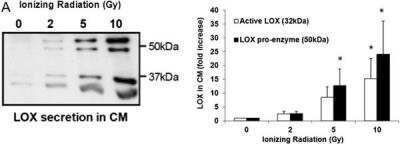 Western Blot: LOX Antibody [NB100-2527]