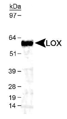 Western Blot: LOX AntibodyBSA Free [NB100-2530]