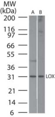 Western Blot: LOX Antibody [NBP2-24877]