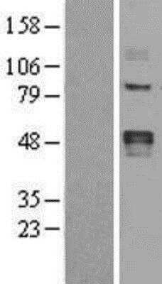 Western Blot: LOX Overexpression Lysate [NBL1-12640]