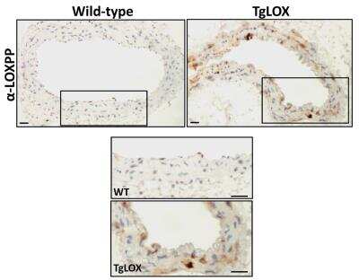 Immunohistochemistry: LOX propeptide Antibody - BSA Free [NB110-41568]