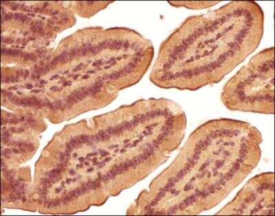 Immunohistochemistry-Paraffin: LOX propeptide Antibody - BSA Free [NB110-41568]