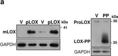 Western Blot: LOX propeptide AntibodyBSA Free [NB110-41568]