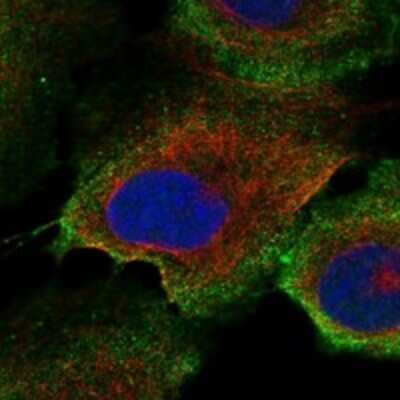 Immunocytochemistry/ Immunofluorescence: LOXHD1 Antibody [NBP3-17165]