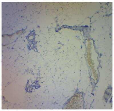 Immunohistochemistry-Paraffin: LOXL1 Antibody [NBP3-12225]