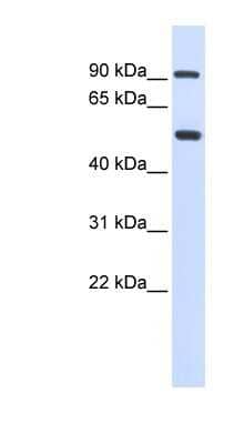 Western Blot: LOXL1 Antibody [NBP1-57939]