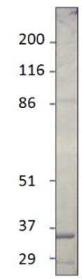 Western Blot: LOXL1 Antibody [NBP3-12225]