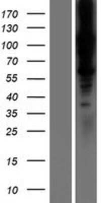 Western Blot: LOXL1 Overexpression Lysate [NBP2-07730]