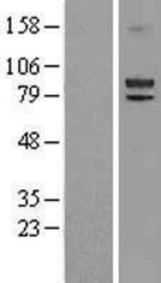 Western Blot: Lysyl Oxidase Homolog 2/LOXL2 Overexpression Lysate [NBL1-12641]