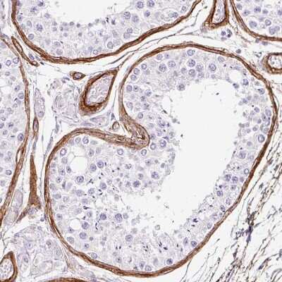 Immunohistochemistry-Paraffin: LOXL4 Antibody [NBP2-32692]