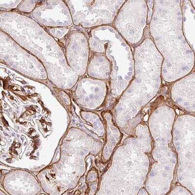 Immunohistochemistry-Paraffin: LOXL4 Antibody [NBP2-32692]