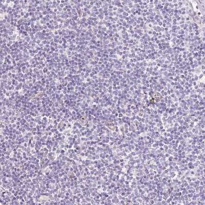 Immunohistochemistry-Paraffin: LOXL4 Antibody [NBP2-32692]