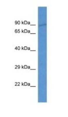 Western Blot: LOXL4 Antibody [NBP1-74257]