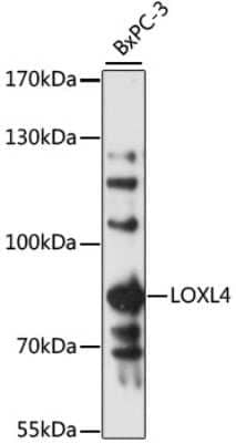 Western Blot: LOXL4 AntibodyAzide and BSA Free [NBP3-04898]