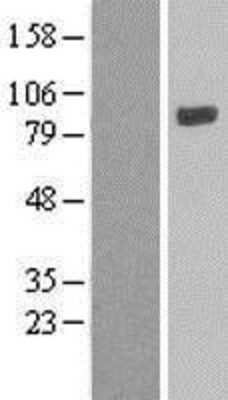 Western Blot: LOXL4 Overexpression Lysate [NBL1-12642]